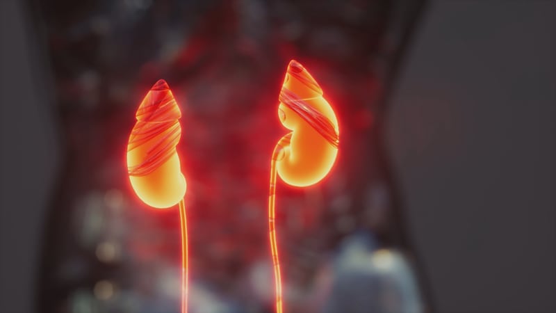 Louisiana sits in 'stone belt' where kidney stones are far more common