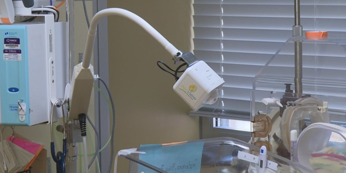 Nicview Images 'NicView' cameras provides 24/7 access for parents with babies in NICU