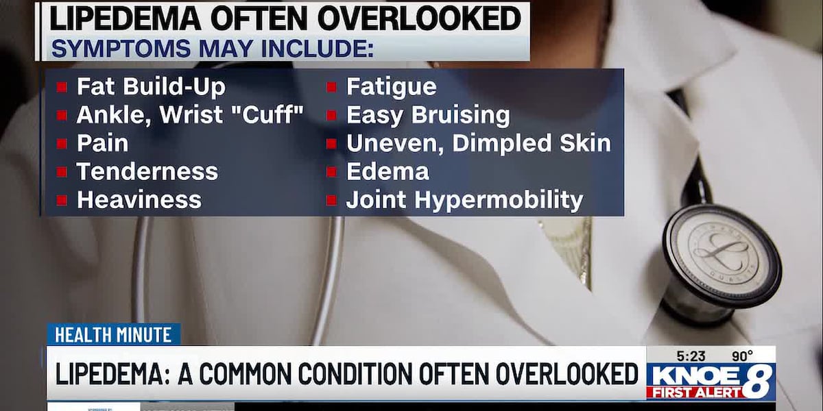 Health Minute: Lipedema is a common condition often overlooked