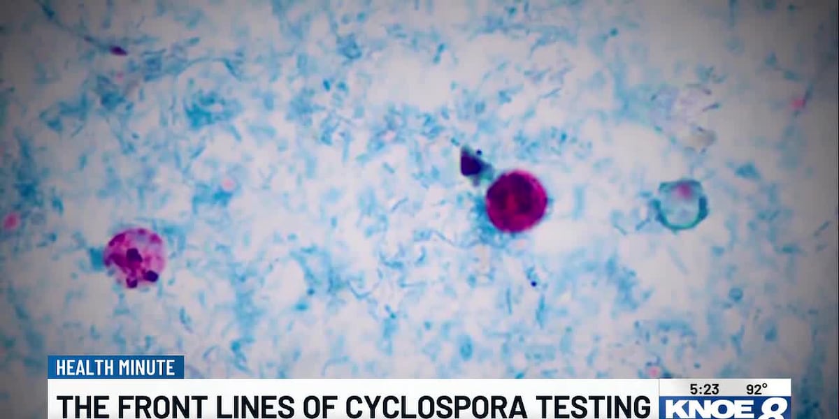 Cyclospora cases rise as CDC investigates multi-state outbreak