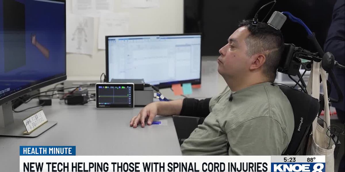 Double neural bypass technology restores movement and sensation in paralyzed patient