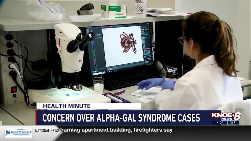 Experts sharing concerns and warning signs of Alpha-Gal Syndrome, a tick-borne illness