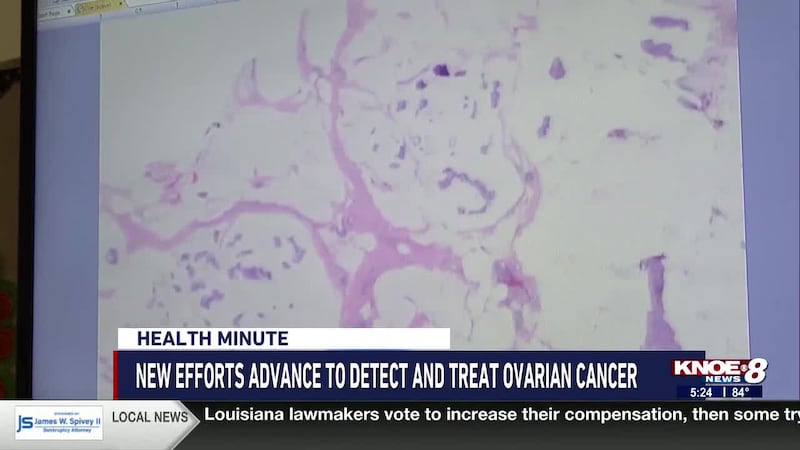 There's no reliable test when it comes to detecting ovarian center, but experts hope AI will...
