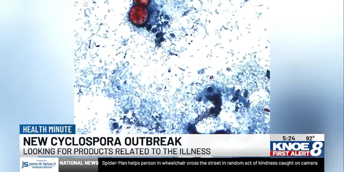 Cases and hospitalizations climb in cyclospora outbreak